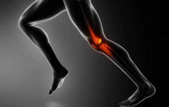 Runners Knee
